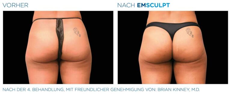 Nachher Bild