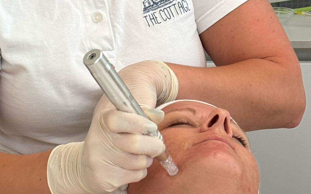 1. Facials & Needling