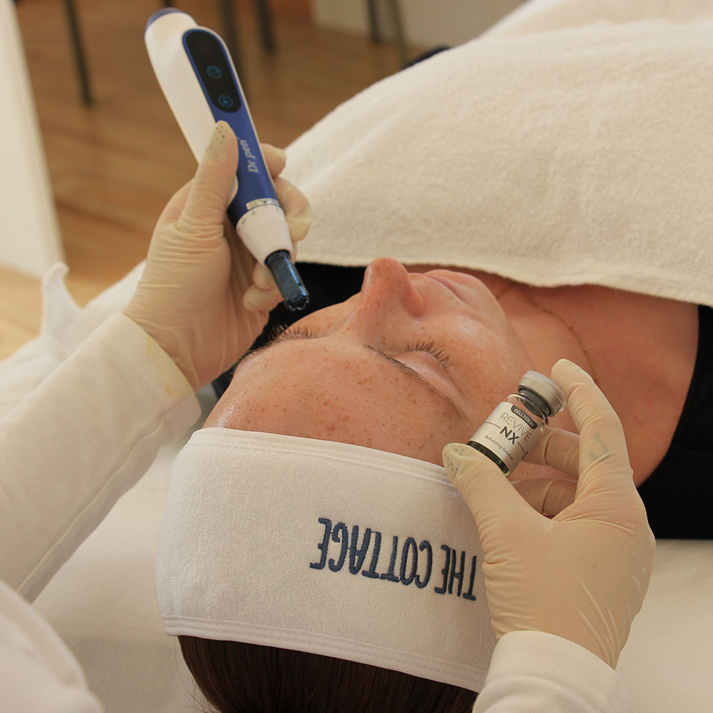 Wie funktioniert Microneedling?